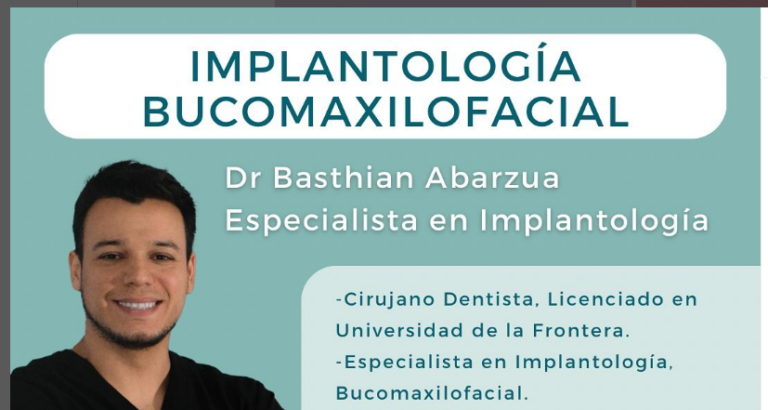 Implantología Bucomaxilofacial : Dr. Basthian Abarzúa